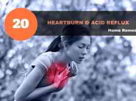 heartburn remedies & acid reflux