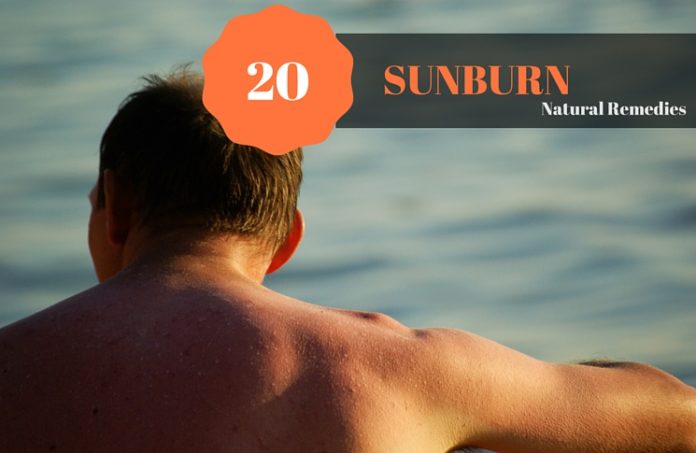 sunburn remedies