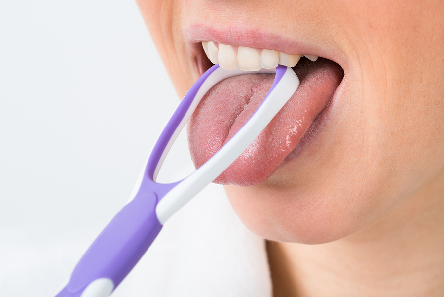 cleaning tongue of the bacteria thata is causing gingivitis