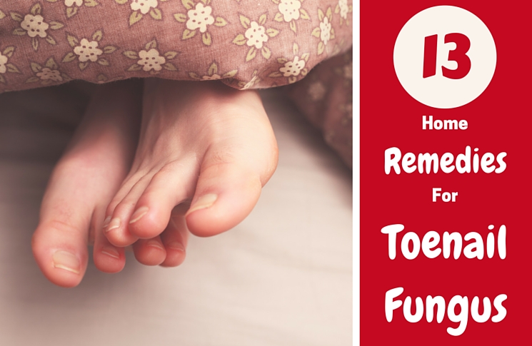 13 home remedies for toenail fungus