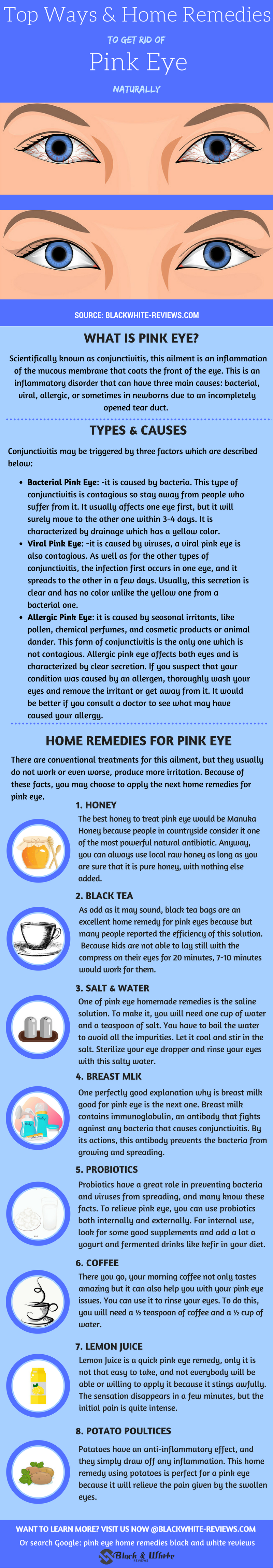 top home remedies to get rid of pink eye
