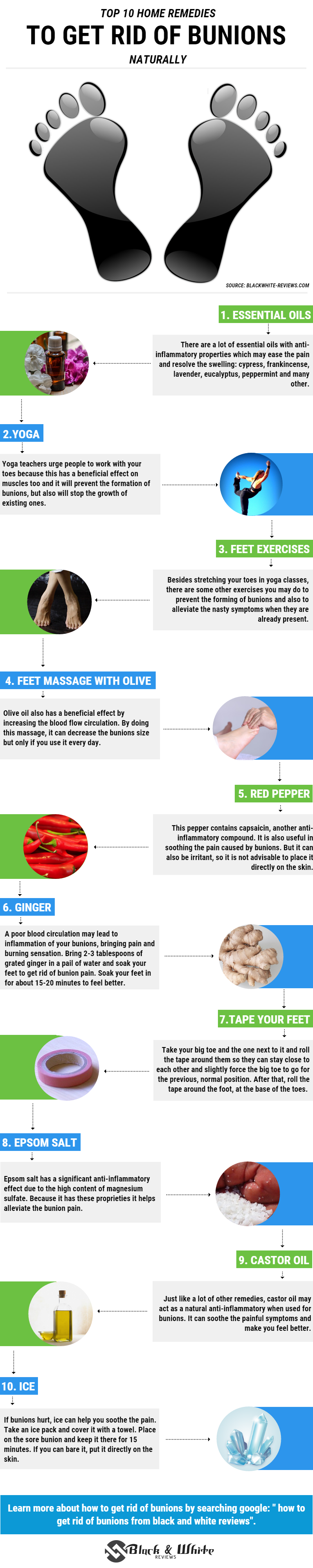 how to get rid of bunions -infographic
